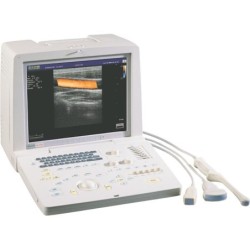 УЗИ-аппарат SSI-1000 портативный