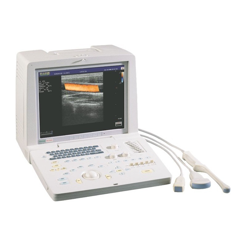 УЗИ-аппарат SSI-1000 портативный