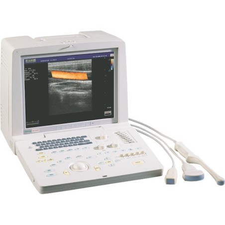 УЗИ-аппарат SSI-1000 портативный