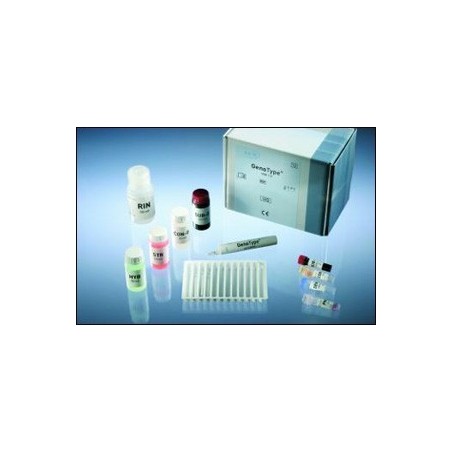 Набор для определения мультирезистентности микобактерий GenoType MTBDRplus (наб-96тест)