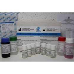 Стероид-ИФА-Тестостерон