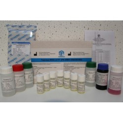 Тироид-ИФА-ат ТГ (Антитела к тиреоглобулину)