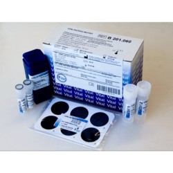 Набор для определения С-реактивный белок СРБ-латекс-Витал В 201.125