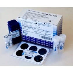 Набор для определения антистрептолизина О Антистрептолизин-О АСЛ(О)-Латекс-Витал (наб-250опр)