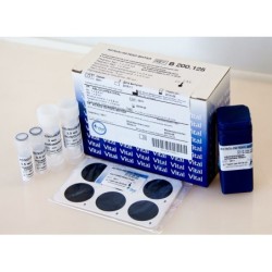 Набор для определения антистрептолизина О Антистрептолизин-О АСЛ(О)-Латекс-Витал (наб-125опр)