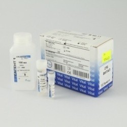 Набор для определения антистрептолизина О Антистрептолизин-О АСЛ(О)-Витал