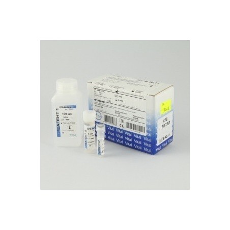 Набор для определения антистрептолизина О Антистрептолизин-О АСЛ(О)-Витал