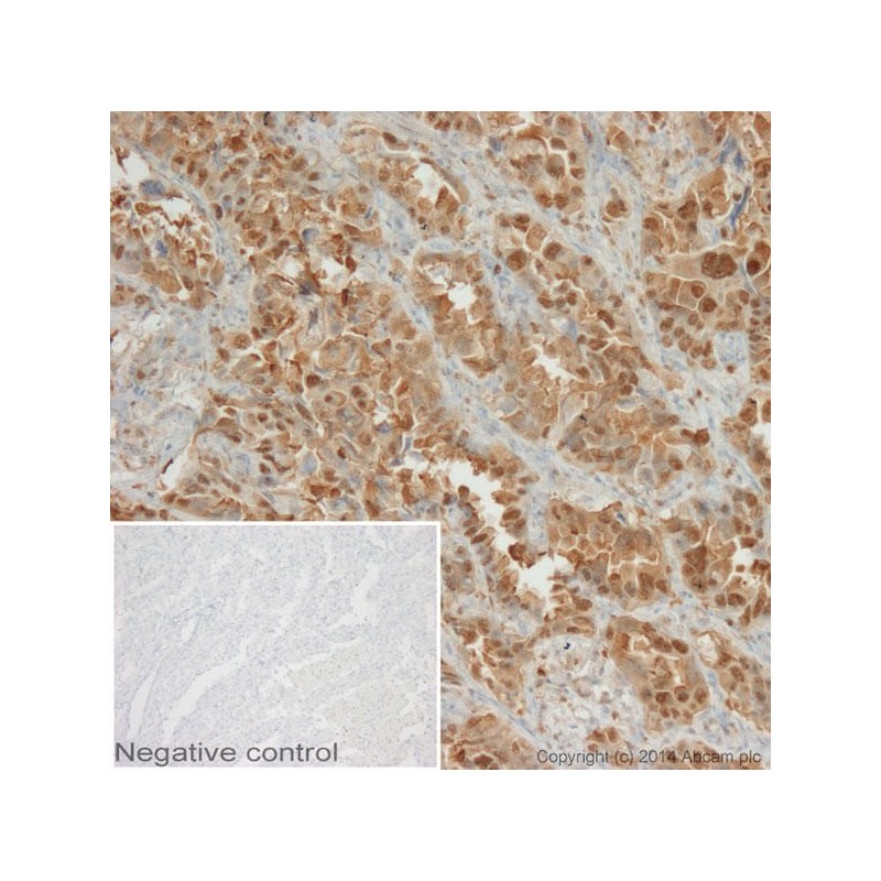 Антитела поликлональные козьи вторичные к мышиным LgM (HRP), 1мг