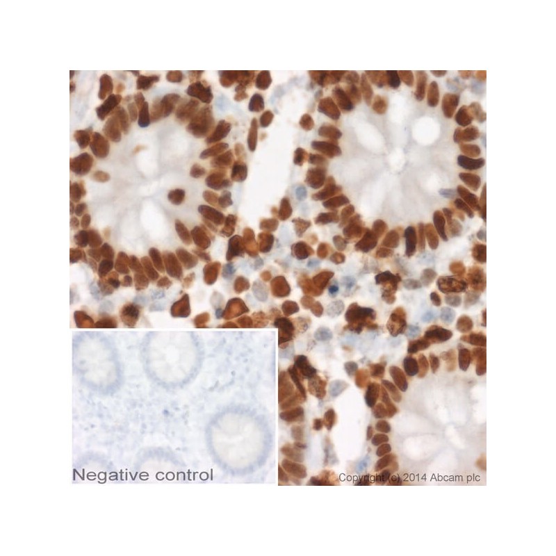 Антитела поликлональные козьи вторичные к мышиным LgG1 (heavy chain)- тяжелая цепь (HRP), 1мг