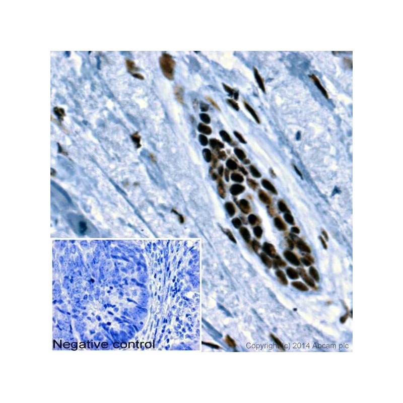 Антитела поликлональные козьи вторичные к мышиным LgG2a (heavy chain)- тяжелая цепь (HRP), 1мг