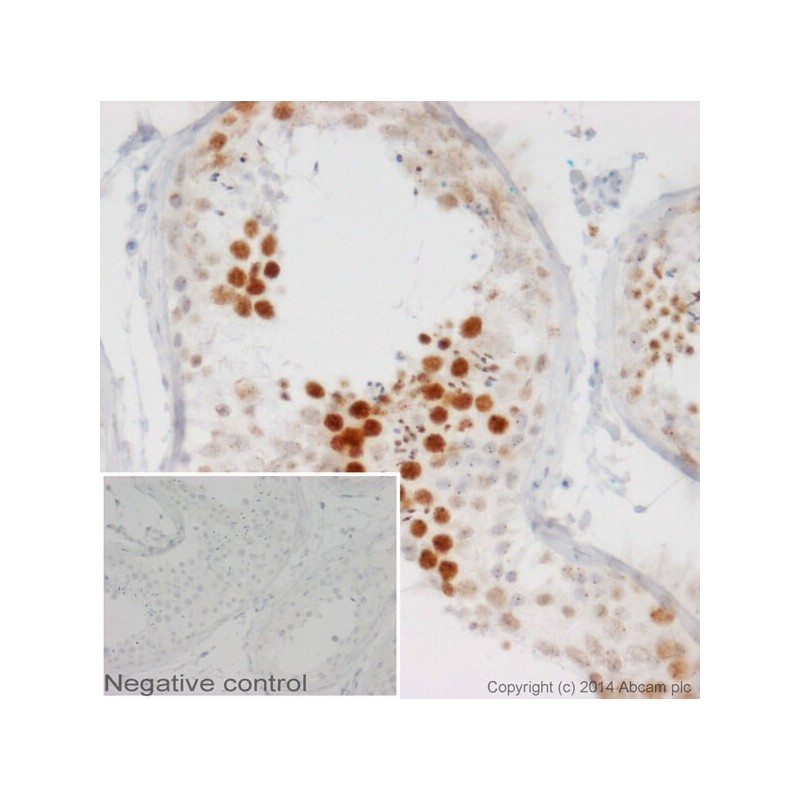 Антитела поликлональные козьи к мышиным LgG2b (heavy chain)- тяжелая цепь (HRP), 1мг