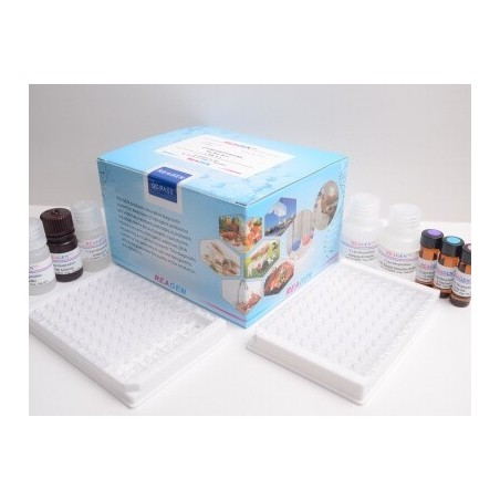 Набор для определения Ципрофлоксацина методом ИФА (1наб-96опр)