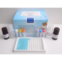 Набор для определения Линкомицин методом ИФА (1наб-96опр)