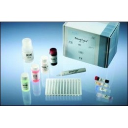 GenoType MTBDRplus