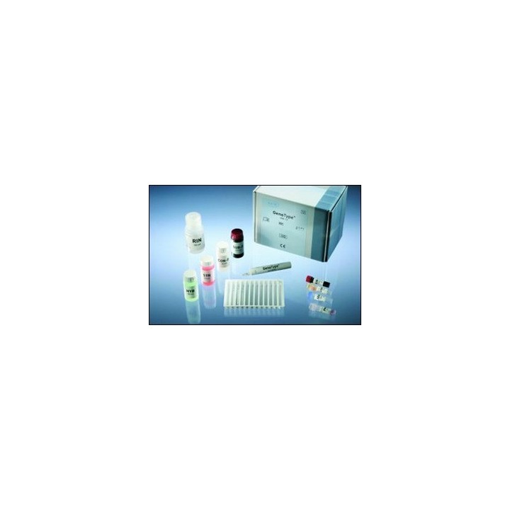 GenoType MTBDRplus