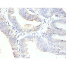 Rabbit Anti-human Antigen KI-67 polyclonal