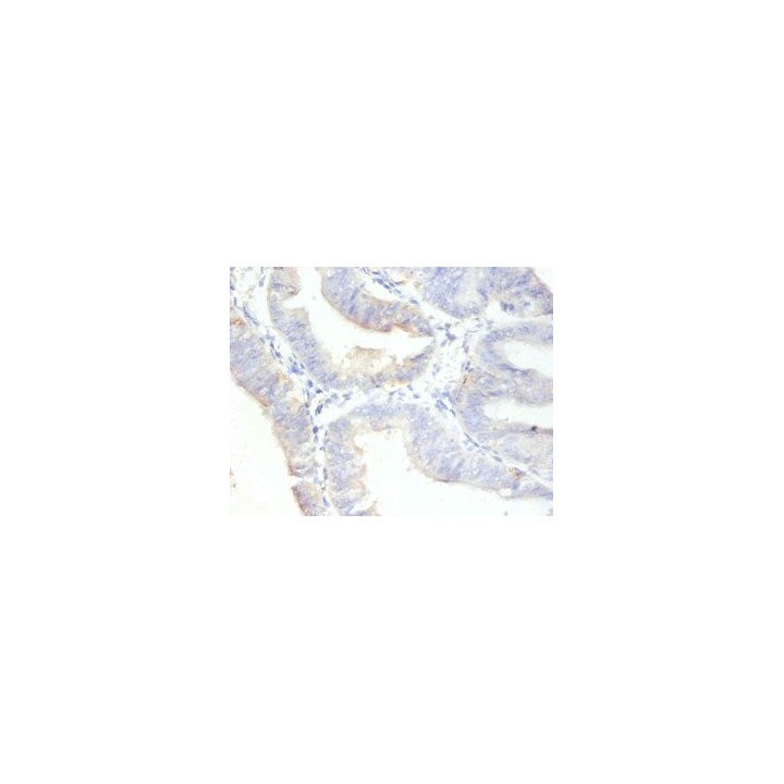 Rabbit Anti-human Antigen KI-67 polyclonal