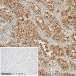 Козьи поликлональные вторичные антителла к мышиным LgM (HRP), 1мг